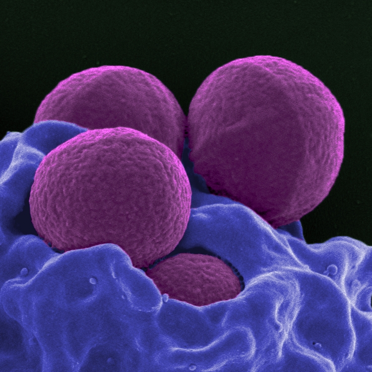 Better Living Through Microbes